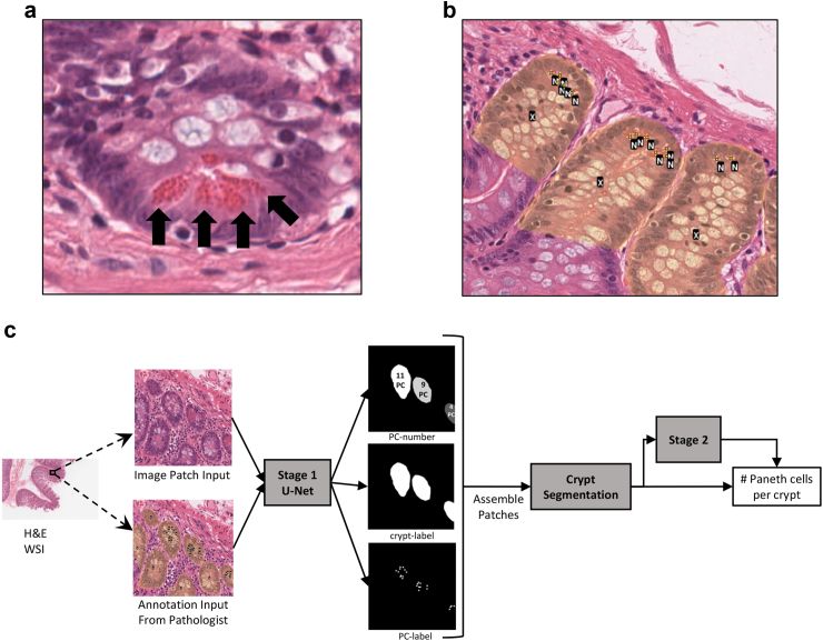 Paneth cells in an intestinal crypt, annotated crypts, and a diagram of the two-stage deep learning pipeline that counts Paneth cells per crypt.